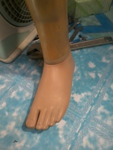 pembuatan kaki palsu atas lutut